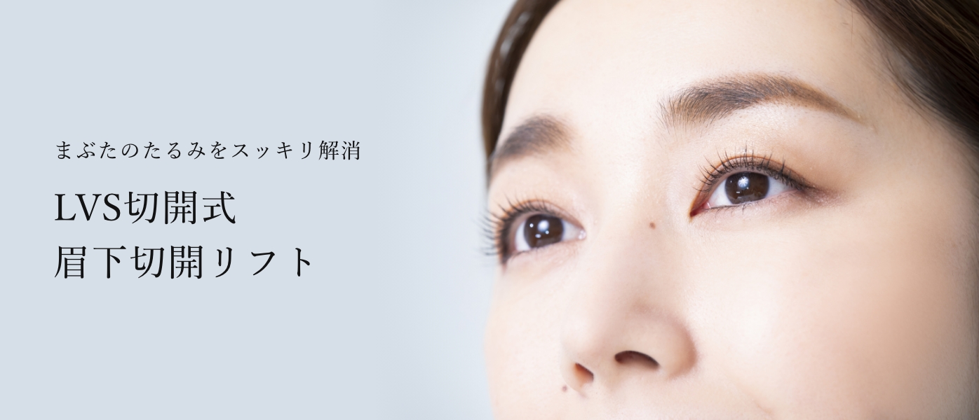 まぶたのたるみをスッキリ解消。LVS切開式7
眉下切開リフト。
