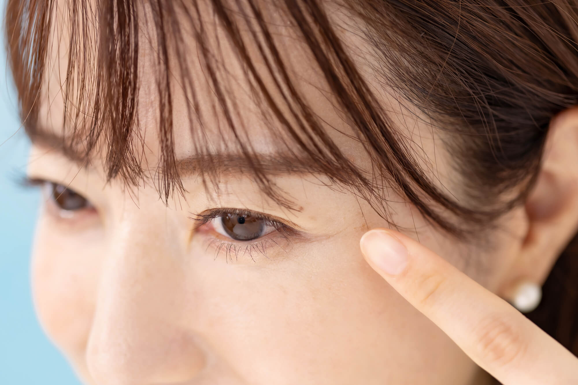 眉上切開とは