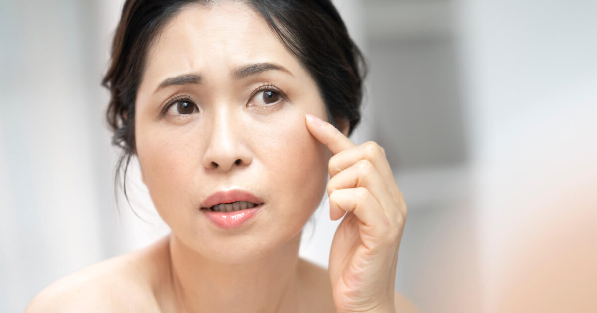 目の下のたるみがひどい原因とは?美容外科医が徹底解説