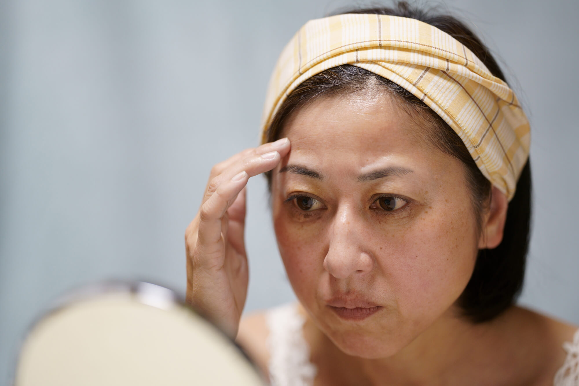 おでこの脂肪注入とは